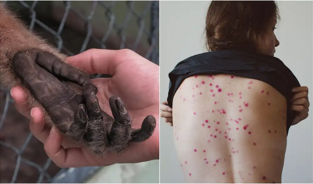 Enfermedad se presentó inicialmente en zonas de selva tropical. Foto: composición LR/El Mundo/Newtral Enfermedad se presentó inicialmente en zonas de selva tropical. Foto: composición LR/El Mundo/Newtral