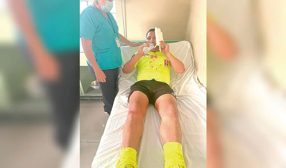 VIOLENCIA. La Copa Perú se tiño de sangre en Cusco, un árbitro fue agredido y podría perder la vista. En Arequipa hubo pelea. VIOLENCIA. La Copa Perú se tiño de sangre en Cusco, un árbitro fue agredido y podría perder la vista. En Arequipa hubo pelea.