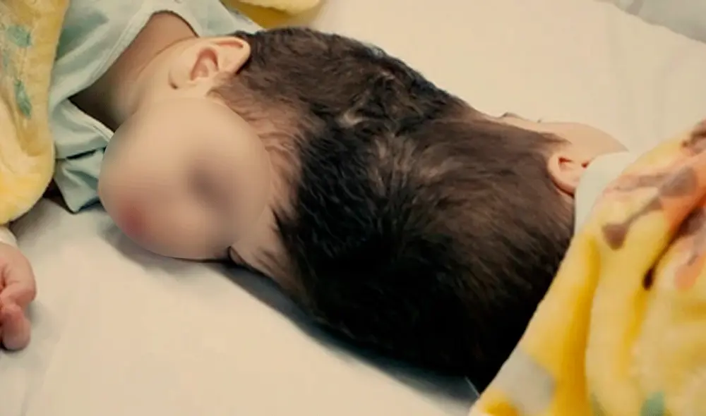 La organización benéfica médica Gemini Untwined, con sede en Londres, que ayudó a llevar a cabo el procedimiento, la describió como “la separación más desafiante y compleja hasta la fecha”. Foto: El Mundo La organización benéfica médica Gemini Untwined, con sede en Londres, que ayudó a llevar a cabo el procedimiento, la describió como “la separación más desafiante y compleja hasta la fecha”. Foto: El Mundo