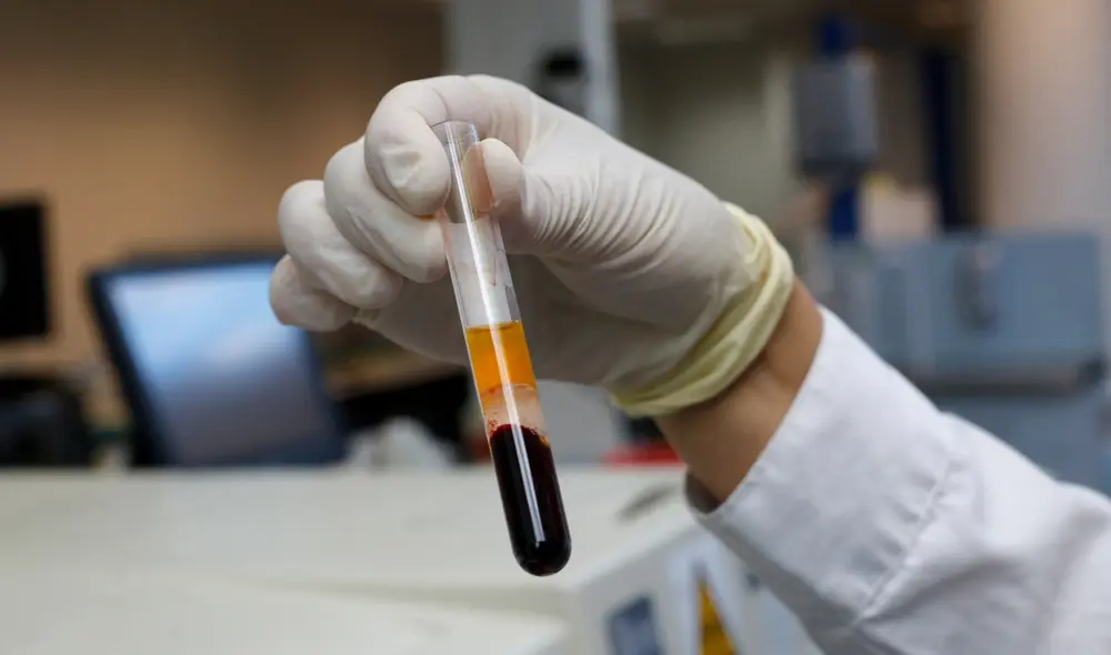 La tecnología OrganEx se inoculó en cadáveres de cerdo y logró que recobrara el funcionamiento de sus órganos. Foto: AFP