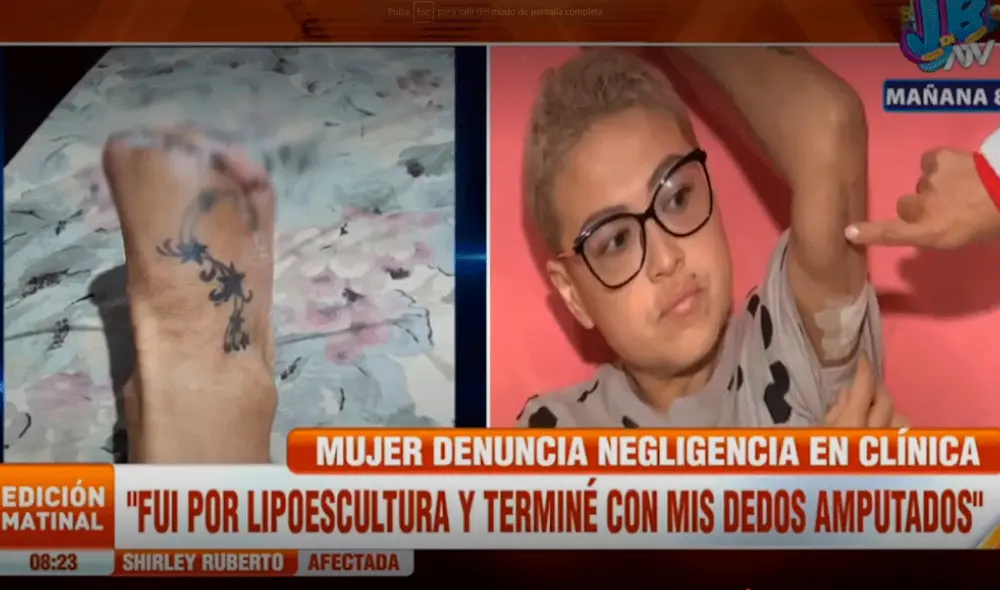 La afectada señaló que el doctor Juan David Córdova cometió negligencia médica y ahora evade su responsabilidad. Video: ATV