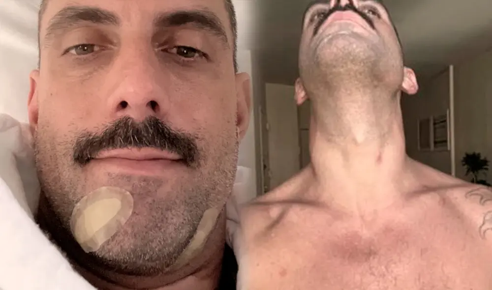 Jeffrey Galaise muestra las secuelas que dejó en su cuerpo la viruela del mono. Todos los días dirige un grupo de apoyo para los afectados por la enfermedad. Foto: Instagram Jeff Galaise