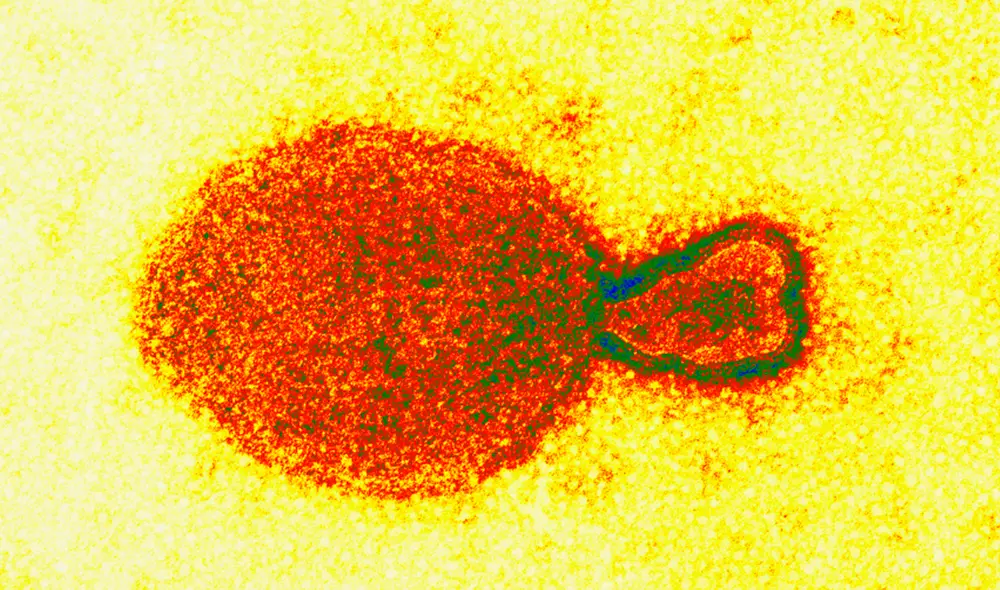 A nivel global, se estima que el 70% de las enfermedades infecciosas emergentes han pasado a los humanos a través del contacto con animales. Foto: Science Image