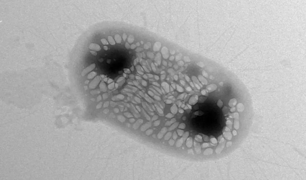 La resistencia a los antibióticos de las bacterias representa un problema grave para la salud, ya que no existen medicamentos para tratar las infecciones que generan. Foto: Anupama Lakshmanan / Caltech