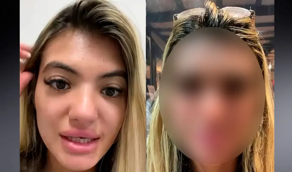 Sirin Murad, una joven británica de 25 años, se durmió al sol durante 30 minutos en Sunny Beach, Bulgaria. Foto: composición LR / Dailymail