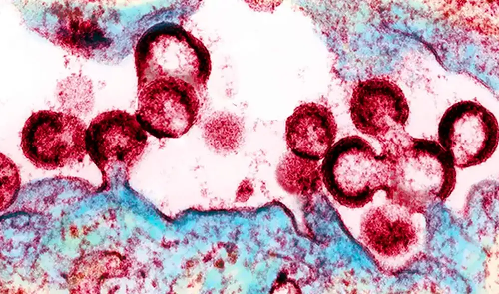 Partículas de VIH emergen de un linfocito CD4 de un paciente. Foto: NIAID Partículas de VIH emergen de un linfocito CD4 de un paciente. Foto: NIAID