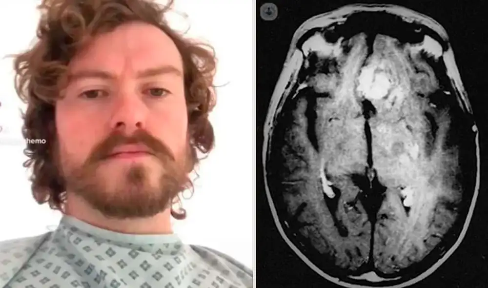 Gracias a una resonancia magnética, Iain pudo descubrir que padecía de cáncer en etapa 3. Foto: Mirror Gracias a una resonancia magnética, Iain pudo descubrir que padecía de cáncer en etapa 3. Foto: Mirror