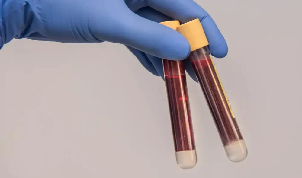 La sangre de tipo RH nula, también llamada "sangre dorada", solo ha sido detectada en 45 personas desde su descubrimiento en la década de 1960. Foto: Pixabay La sangre de tipo RH nula, también llamada "sangre dorada", solo ha sido detectada en 45 personas desde su descubrimiento en la década de 1960. Foto: Pixabay