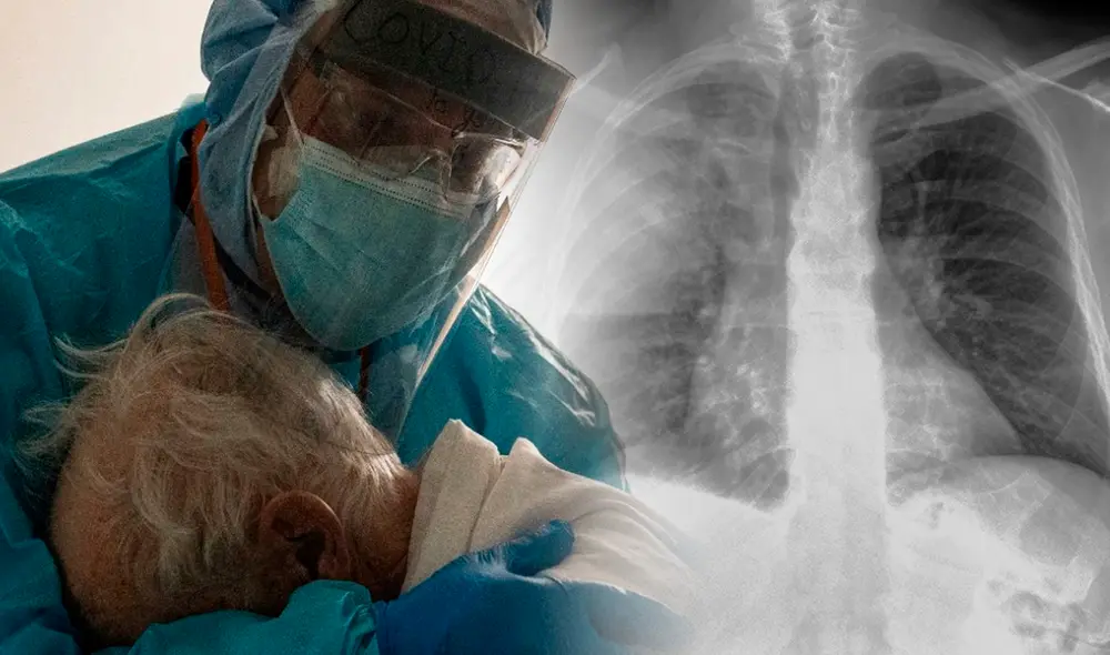 El ministerio de Salud descartó entre los contagiados que se trate de COVID-19, gripe o influenza. Foto: AFP/referencial