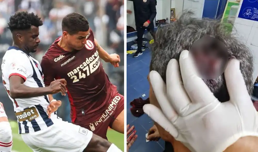 Alianza Lima y Universitario se enfrentaron por la fecha 10 del Torneo Clausura. Foto: composición GLR/Universitario