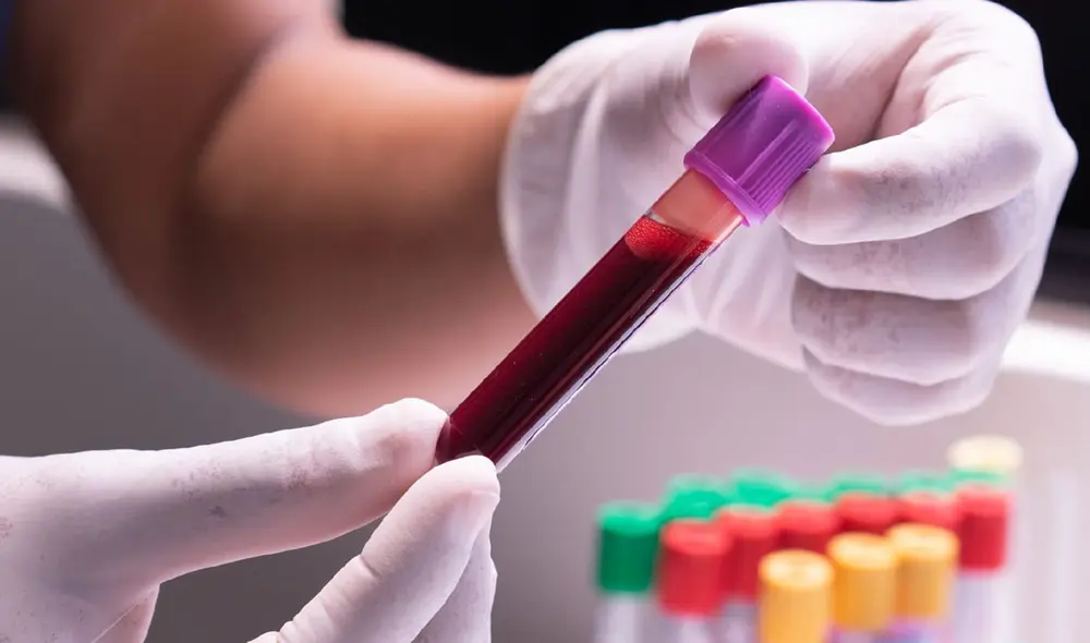 Los científicos identificaron una asociación entre el tipo de sangre y el riesgo de sufrir derrame cerebral. Foto: imaware Los científicos identificaron una asociación entre el tipo de sangre y el riesgo de sufrir derrame cerebral. Foto: imaware