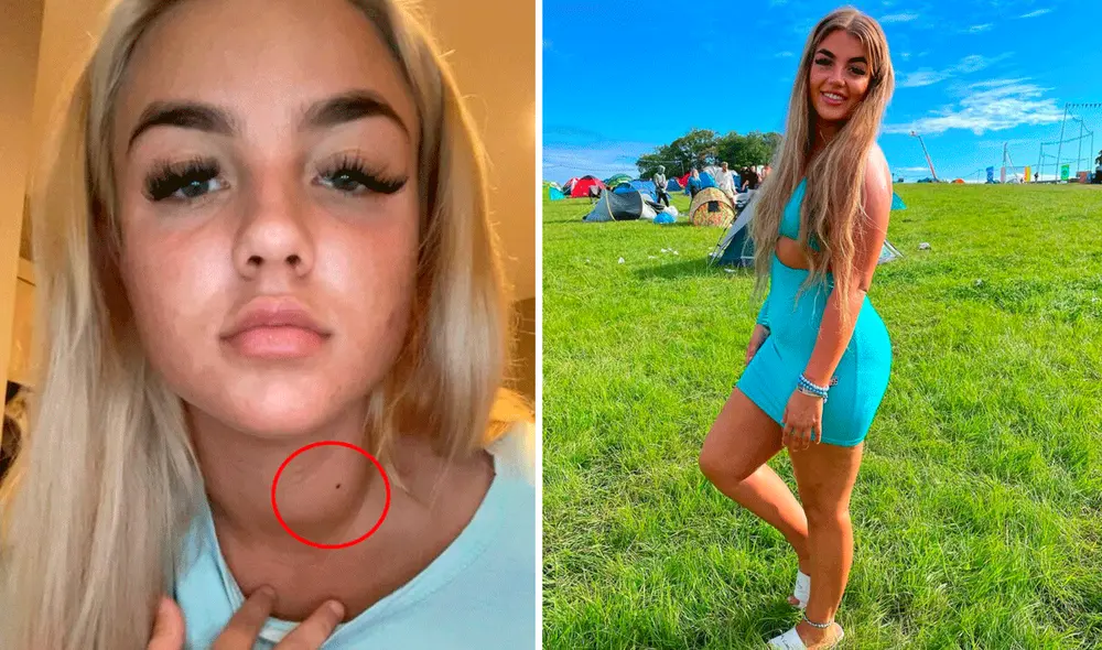 Tras enterarse de su enfermedad, Courtney Nettleton empezó un tratamiento. Ha sido sometida a varias cirugías y sigue lidiando con el cáncer. Foto: TikTok/@courtneypaigenettleton/Need Tok Now Tras enterarse de su enfermedad, Courtney Nettleton empezó un tratamiento. Ha sido sometida a varias cirugías y sigue lidiando con el cáncer. Foto: TikTok/@courtneypaigenettleton/Need Tok Now