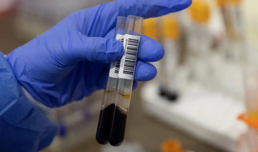 El estudio Pathfinder se basó en 6.621 personas de más de 50 años que no habían sido diagnosticadas de cáncer ni tenían síntomas de la enfermedad. Foto: AFP