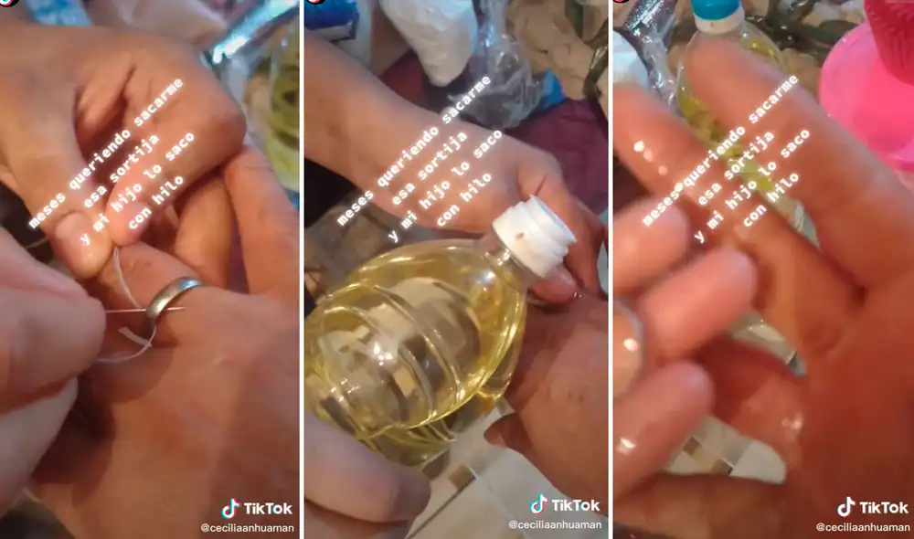 La mujer quedó asombrada por la sencilla forma para sacarse el anillo. Foto: composición LR/captura de TikTok/@Ceciliaanhuaman