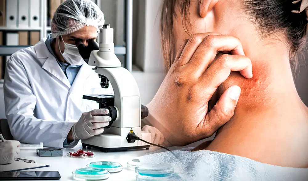 El lupus es una enfermedad inflamatoria autoinmune y crónica relacionada con el sistema inmunológico. Créditos: composición La República/Freepik