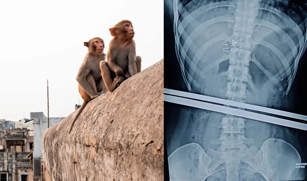 No está claro si la víctima logrará recuperarse por completo. Foto: composición LR/New York Post/Outsider