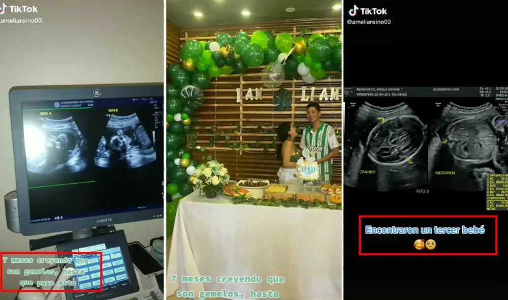 Ellos se enteraron de la noticia cuando la mujer tenía siete meses de gestación. Foto: composición LR/captura de TikTok/@ameliareino03 Ellos se enteraron de la noticia cuando la mujer tenía siete meses de gestación. Foto: composición LR/captura de TikTok/@ameliareino03