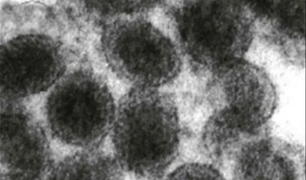 Partículas de arterivirus, como el que han sido objeto de este estudio. Foto:  Fauquet, C.M., et al.