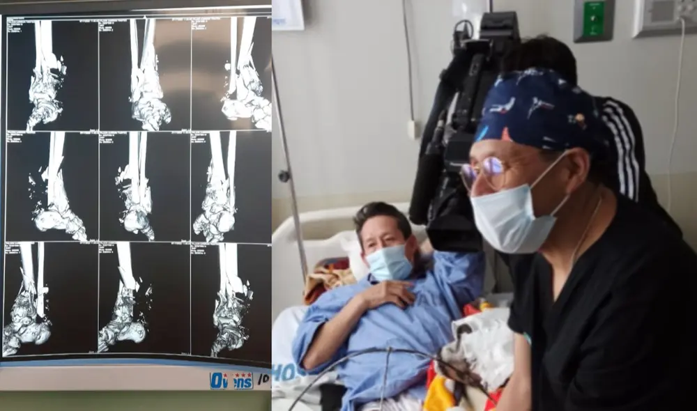 Paciente de recupera de una intervención quirúrgica. Foto: Alexander Flores/URPI