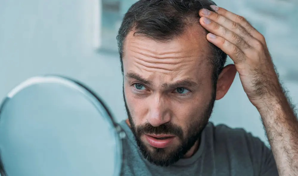 La mayoría de países en los que se encuentran más hombres calvos pertenecen a Europa, seguido de naciones asiáticas. Foto: Pexels La mayoría de países en los que se encuentran más hombres calvos pertenecen a Europa, seguido de naciones asiáticas. Foto: Pexels