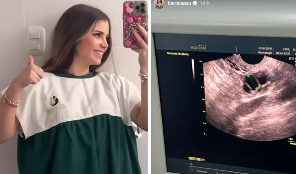 Flavia Laos inició el proceso para congelar sus óvulos. Foto: Flavia Laos/Instagram Flavia Laos inició el proceso para congelar sus óvulos. Foto: Flavia Laos/Instagram