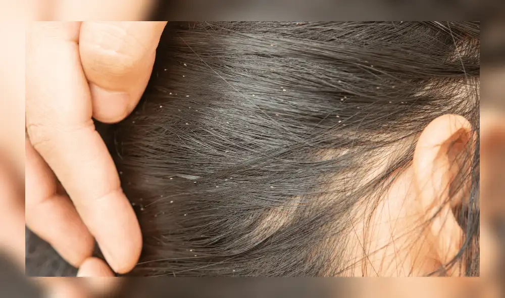 La menor pesaba 22 kilos, tenía gingivitis y pulpitis. Foto: FarmaBaix La menor pesaba 22 kilos, tenía gingivitis y pulpitis. Foto: FarmaBaix