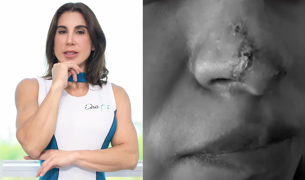 Dos jóvenes denunciaron a la conocida influencer de haberles desfigurado el rostro. Foto: composición LR/Dra. Fit Maria Elena Leiva/ "Magaly Tv, la firme"