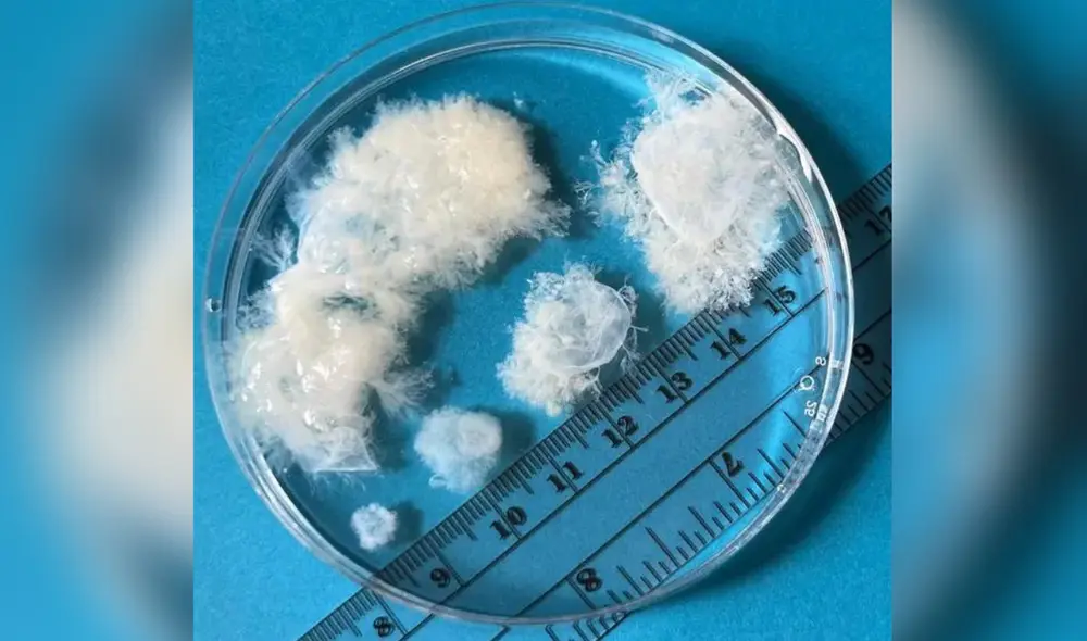 Progresión de la quinta a la novena semana de embarazo. Foto: Red MYA