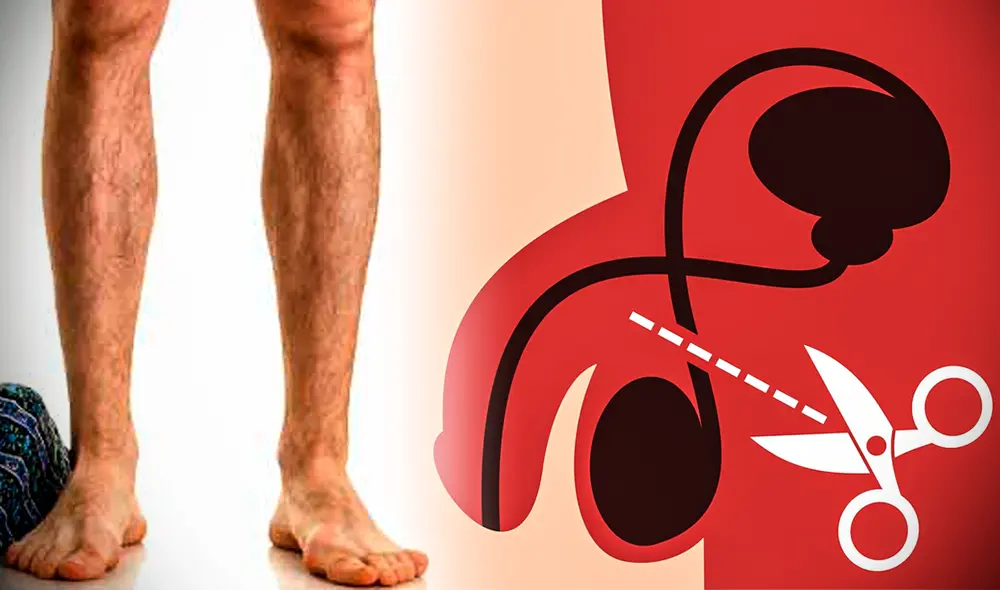 Aunque las cifras históricas son bajas, actualmente más hombres jóvenes en EE. UU. deciden optar por la vasectomía. Foto: composición LR/ Pinterest/ Shutterstock