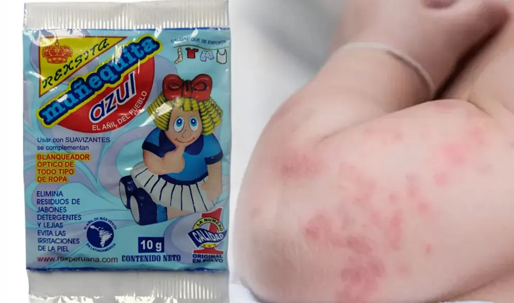 ¿Por qué no debes usar Muñequita Azul para tratar el sarpullido en bebés?