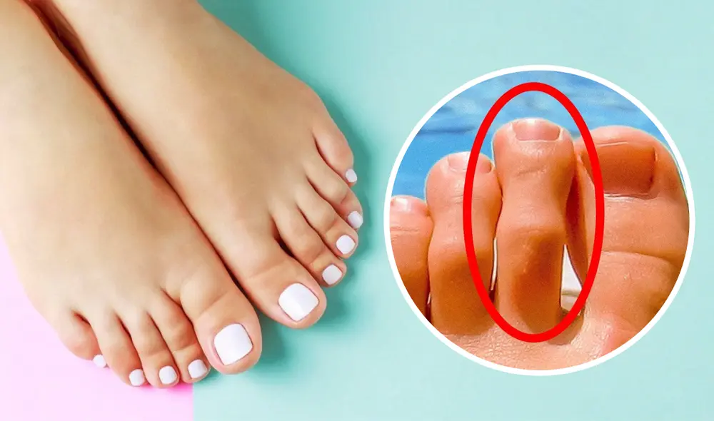 La forma de tus pies puede sugerir características de tu personalidad. Foto: composición LR/Medi Plus/Diario AS