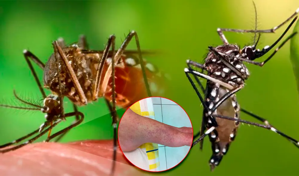 La chikungunya es la nueva enfermedad que está dejando consecuencias en Latinoamérica. Foto: composición LR/Marca/UNSAM La chikungunya es la nueva enfermedad que está dejando consecuencias en Latinoamérica. Foto: composición LR/Marca/UNSAM