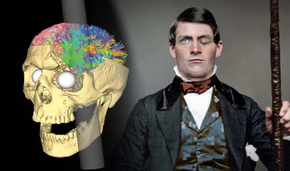 Estados Unidos Phineas Gage Biograf a El Hombre Que Vivi 12 A os 
