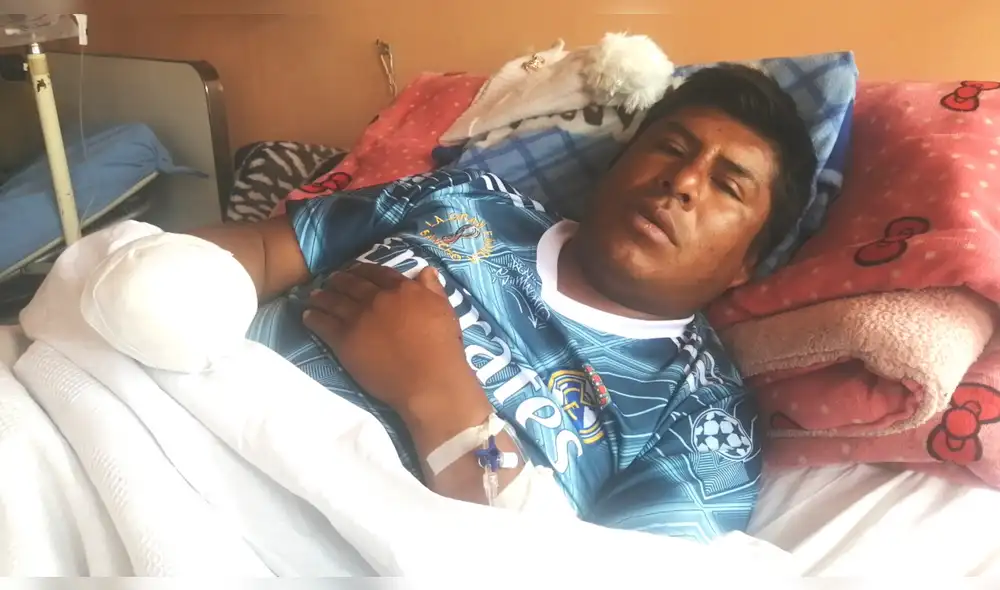 Perdió la mano. Silva se recupera en hospital de Juliaca. Foto: La República. Perdió la mano. Silva se recupera en hospital de Juliaca. Foto: La República.
