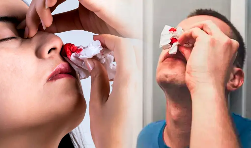 Es común que la nariz te empiece a sangrar debido a resfriados o irritaciones. Foto: composición LR/Salud180