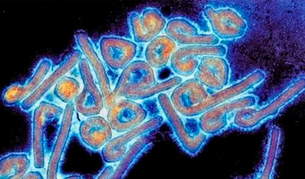 Según la directora regional de la OMS para África, el virus de Marburgo "es altamente infeccioso". Foto: Universidad de Texas Medical Branc