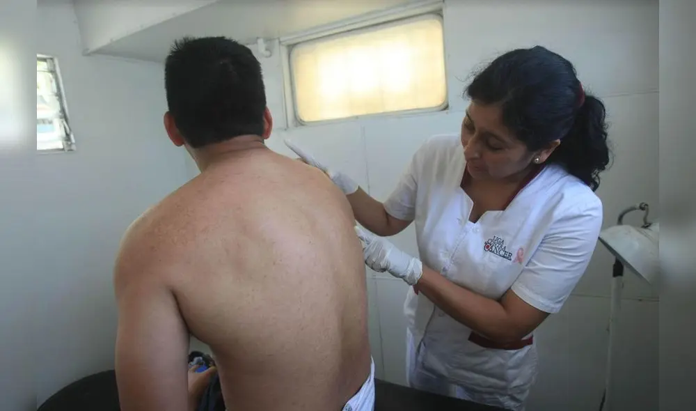 Médicos recomiendan que la población participe del despistaje cáncer de piel. Foto: La República Médicos recomiendan que la población participe del despistaje cáncer de piel. Foto: La República