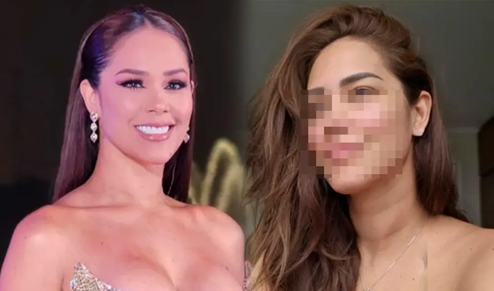 Karen Schwarz viene llevando tratamiento para superar su padecimiento en la piel. Foto: composición/Karen Schwarz/Instagram