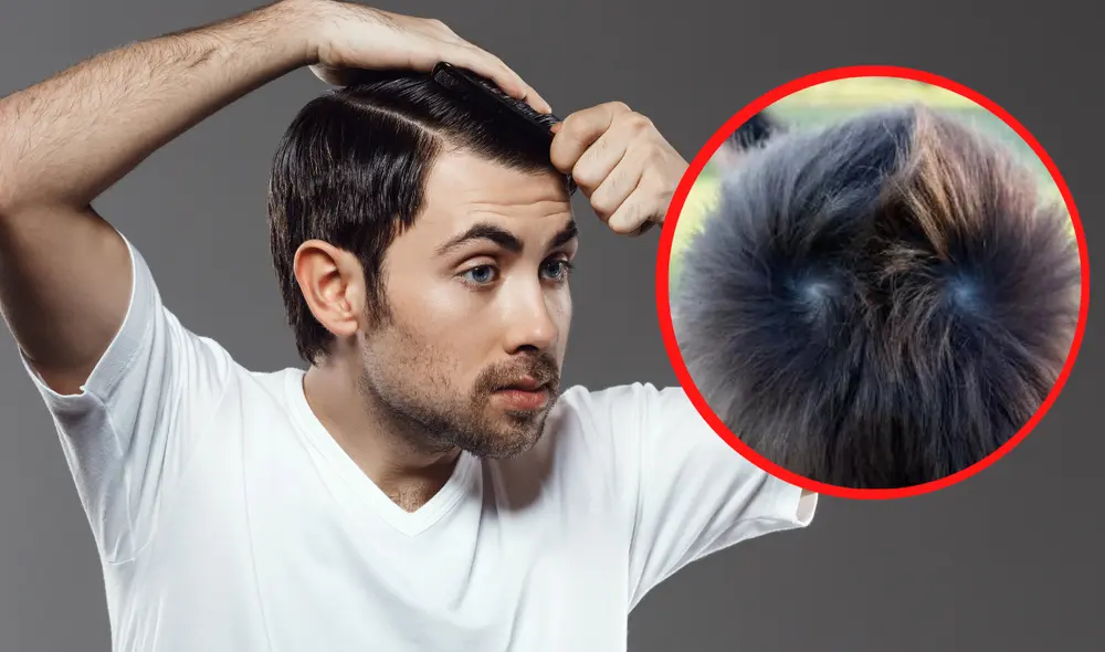 Los remolinos en el cabello se pueden acentuar con un peinado adecuado. Foto: composición La República/Freepik/difusión