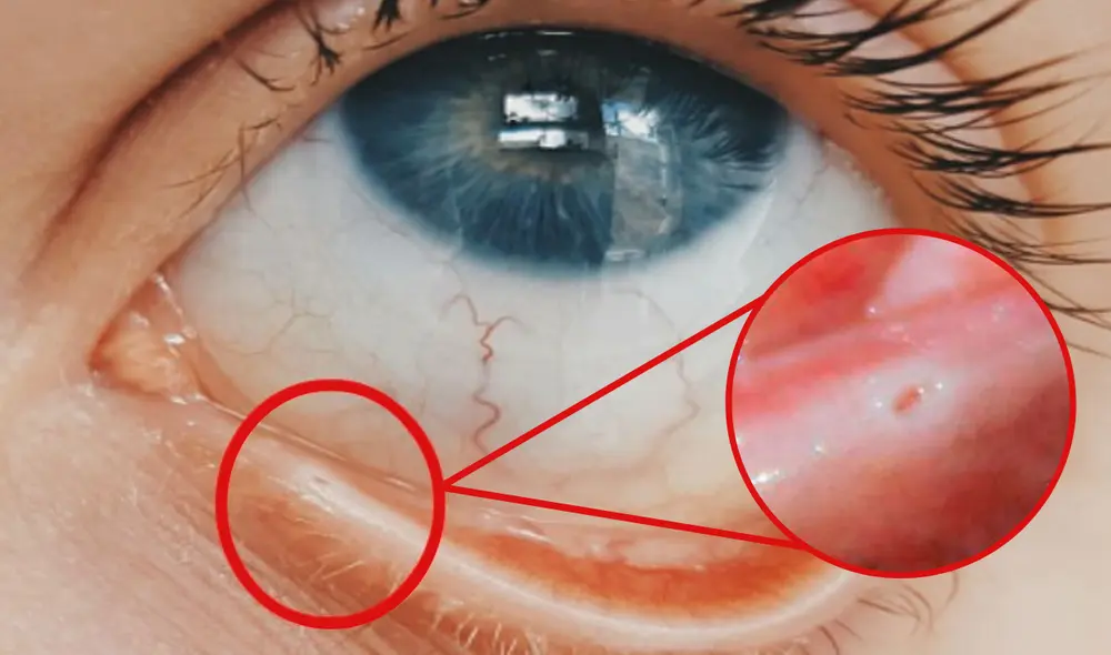 Los pequeños agujeros dentro del párpado son conocidos como puntos lagrimales. Foto: composición LR/Salud180/Cultura Colectiva