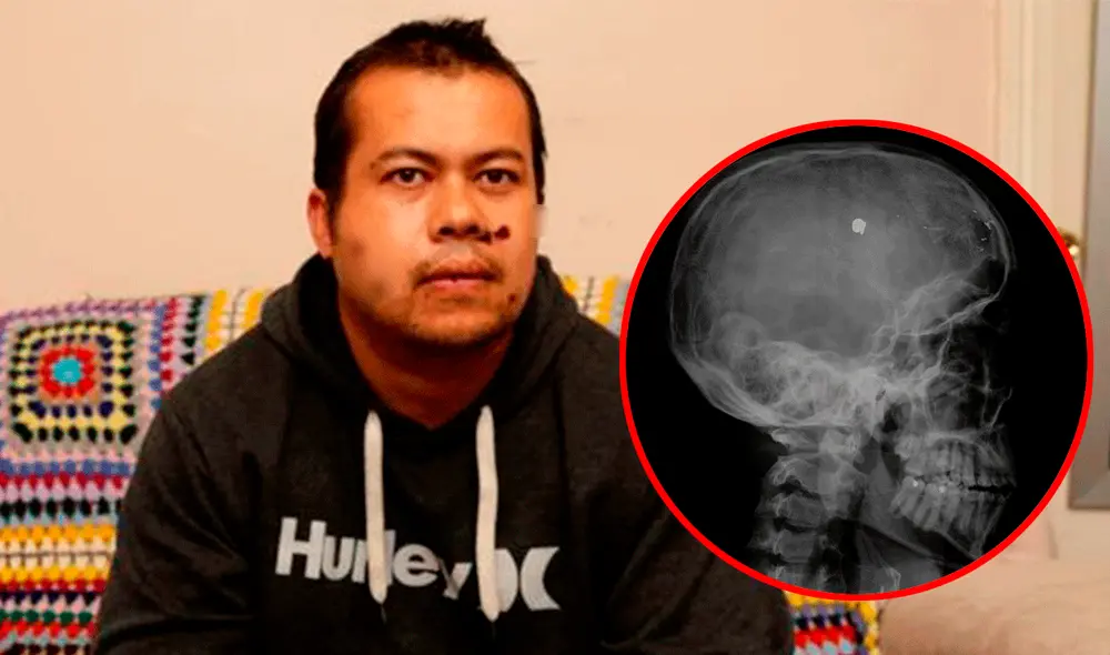 En total, James Myers recibió 5 balas en la cabeza. Foto: composición LR / BBC News Mundo / Infobae