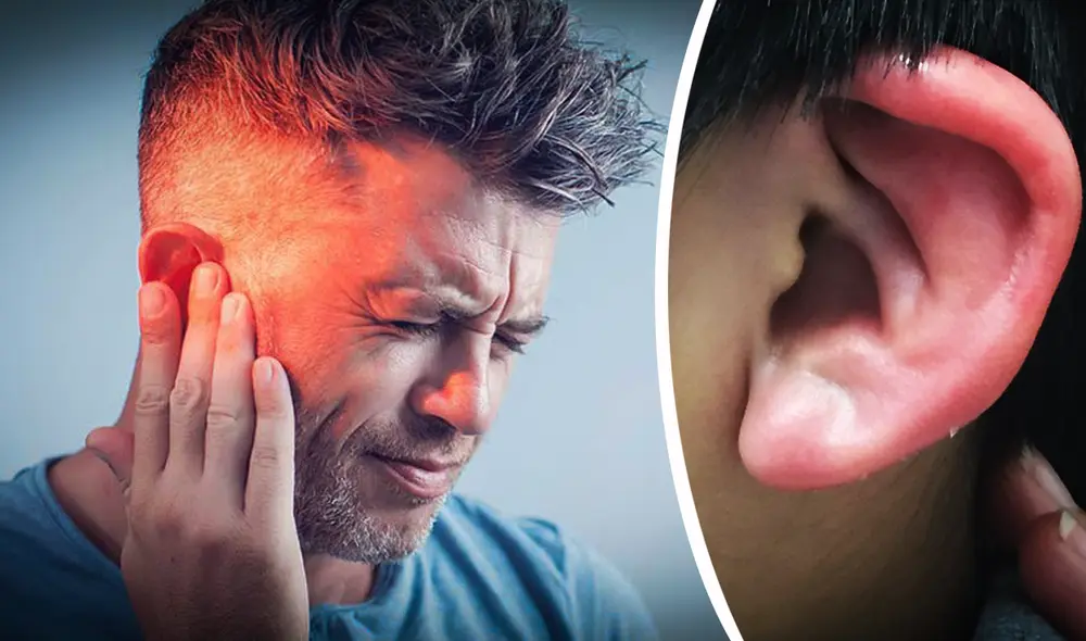 ¿Es cierto que alguien habla mal de ti cuando te arde la oreja? Esto dice la ciencia. Foto: composición La República/CIOF Bolivia/BMJ Journals