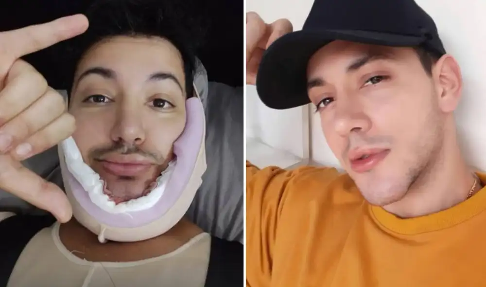 Jean Paul Santa María se sometió a procedimiento estético. Foto: Instagram Jean Paul Santa María se sometió a procedimiento estético. Foto: Instagram