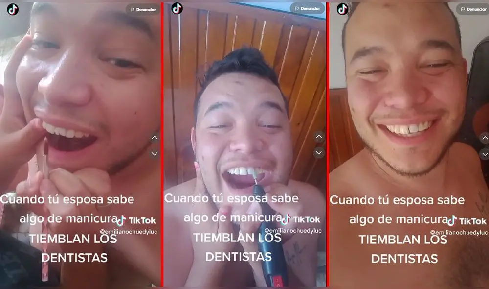 Varios dentistas comentaron la publicación y lo tomaron con humor. Foto: captura TikTok/emilianohuedyluc Varios dentistas comentaron la publicación y lo tomaron con humor. Foto: captura TikTok/emilianohuedyluc