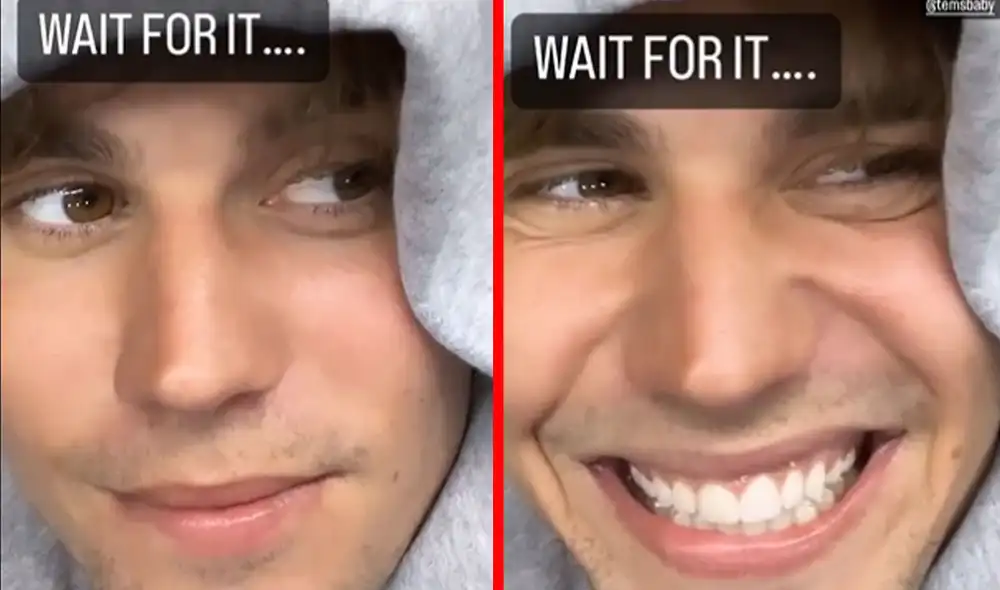 Justin Bieber parece dejar atrás la dolencia física que lo alejó de los escenarios. Foto: Instagram Justin Bieber Justin Bieber parece dejar atrás la dolencia física que lo alejó de los escenarios. Foto: Instagram Justin Bieber