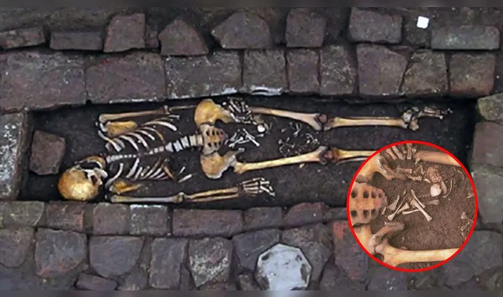 Los restos tenían un orificio en el cráneo. Foto: composición LR/ World Neurosurgery Los restos tenían un orificio en el cráneo. Foto: composición LR/ World Neurosurgery