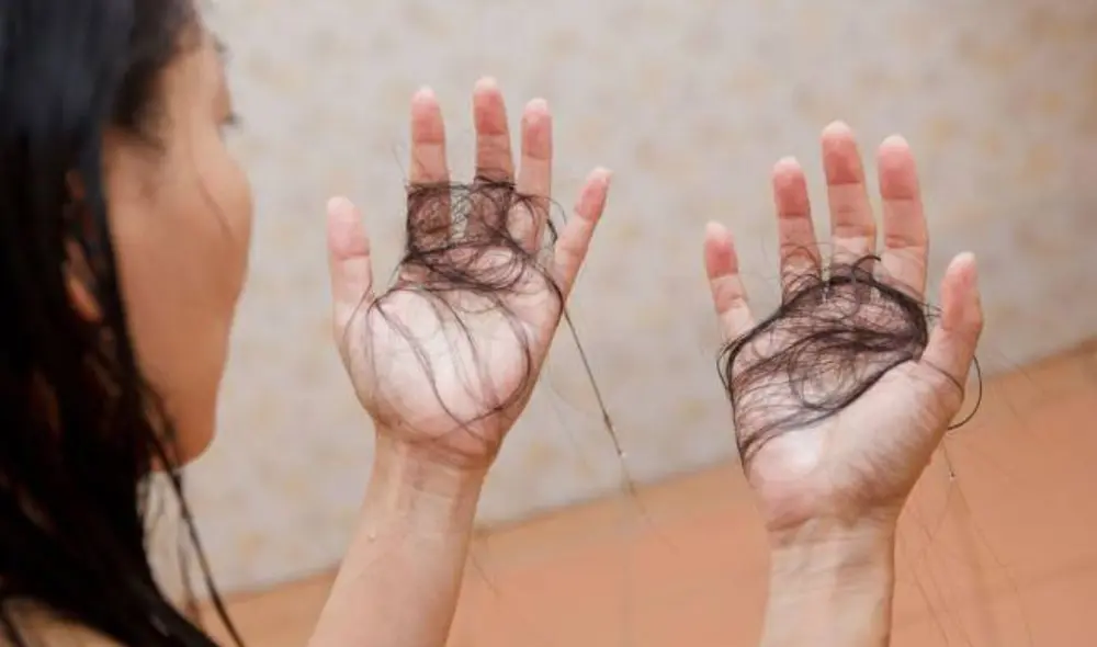 Los especialistas detallan que al día perdemos aproximadamente 100 cabellos. Foto: AS