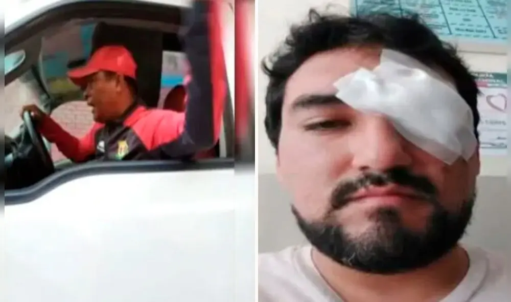 Agraviado tuvo que ser operado de la vista y estuvo a milímetros de quedar ciego tras el ataque. Foto: ATV - Video: "ATV noticias"