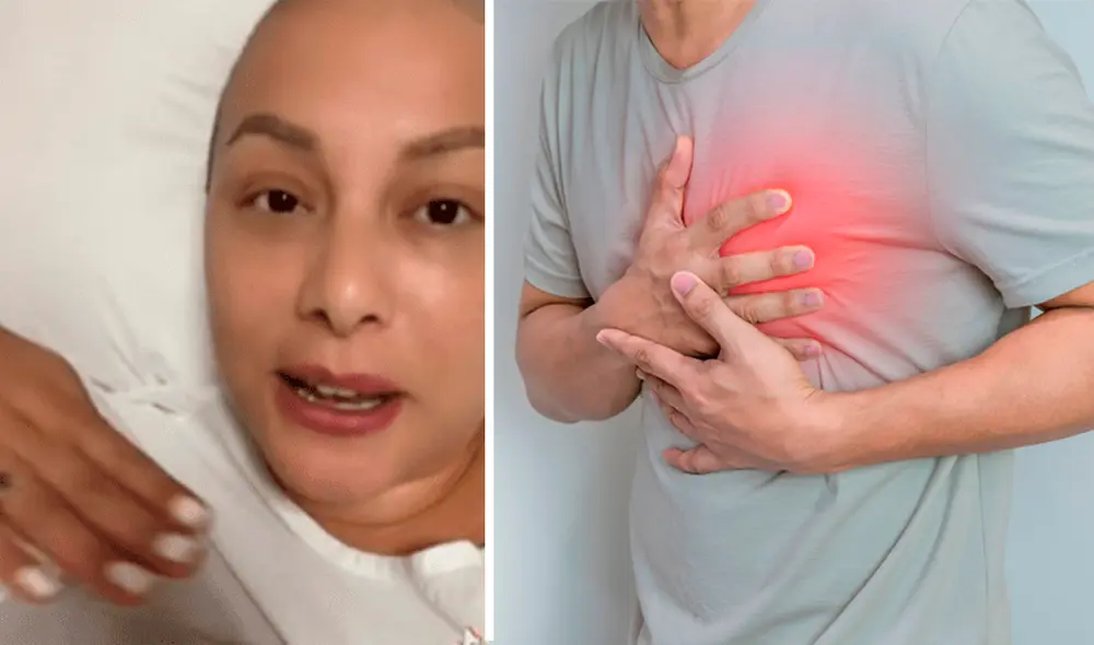 Esta afección fue un efecto secundario de sus quimioterapias. Foto: composición LR