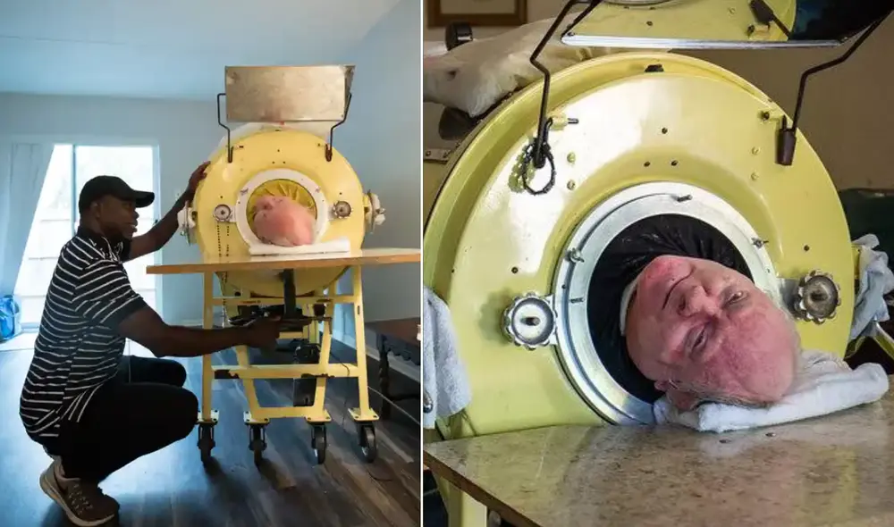 Paul Alexander tiene 77 años de edad y fue infectado con polio cuando era niño. Foto: composición LR/The Guardian/El Sol Paul Alexander tiene 77 años de edad y fue infectado con polio cuando era niño. Foto: composición LR/The Guardian/El Sol